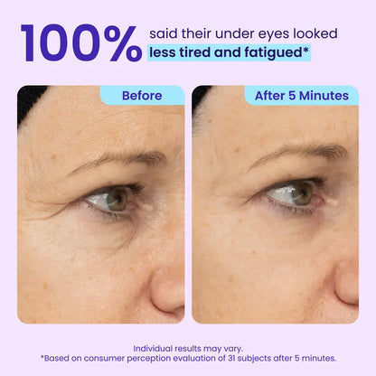 Lazymiracle™  Instant Lift Eye Gel ✨