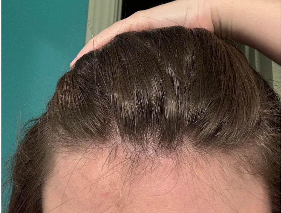 Natural Scalp Scrub