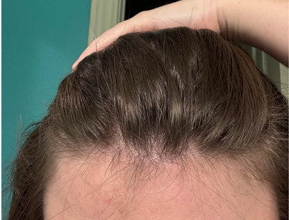 Natural Scalp Scrub